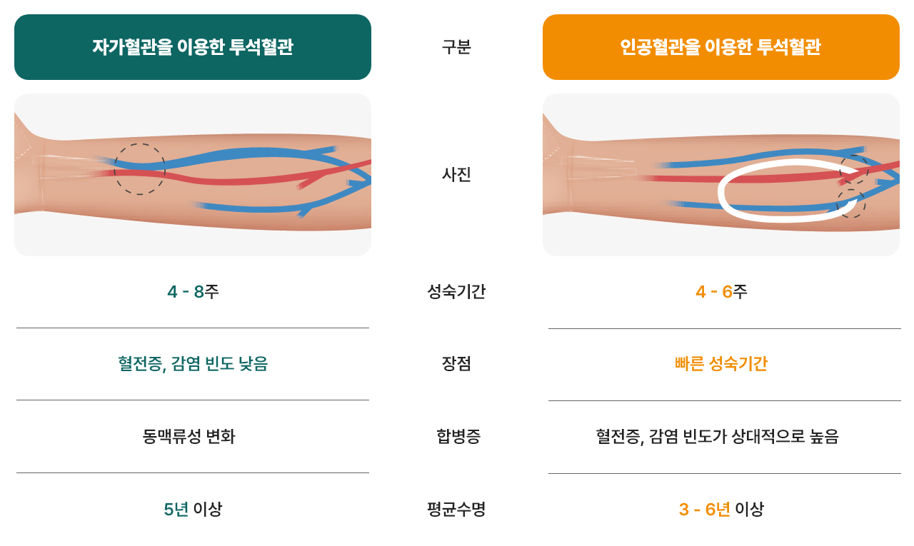 투석혈관 조성술 이미지