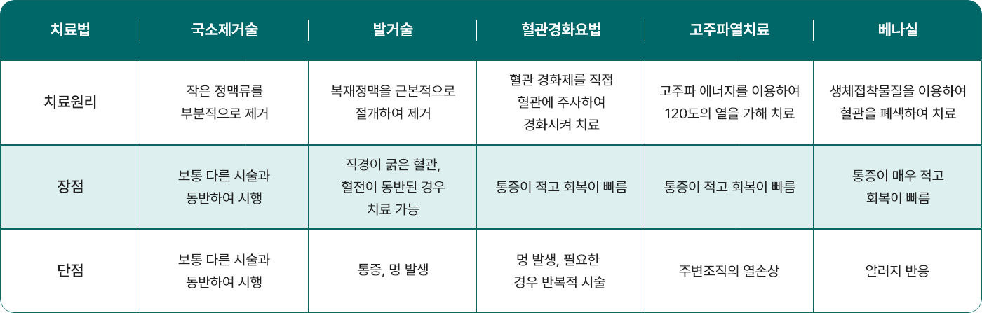 하지정맥류 치료방법