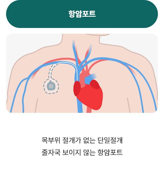 항암포트